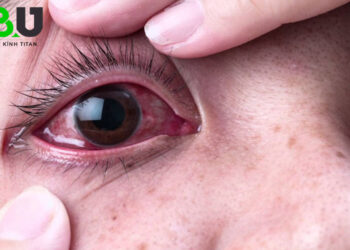 kinh-ap-trong-danh-bai-1307