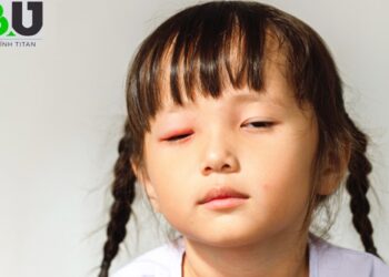 nguyen-nhan-dau-mat-do-va-cach-chua-tri-2609