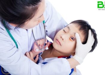 be-bi-dau-mat-do-2710