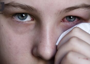 dau-mat-do-co-bi-lai-khong-0411