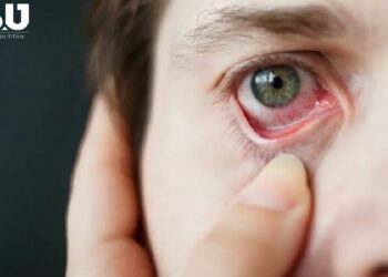 dau-mat-do-la-gi-1211