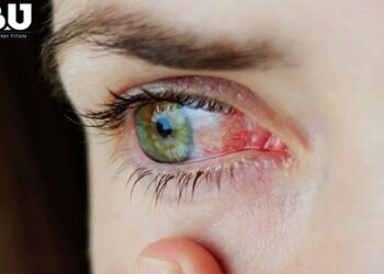 dau-mat-do-nang-1011