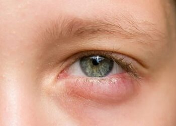 hinh-anh-dau-mat-do-1911