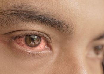 dau-mat-do-uong-ruou-co-sao-khong-2102