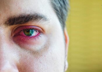 kinh-ap-trong-nhin-xuyen-bai-2302