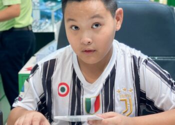 Loạn thị bẩm sinh có tăng độ không? Loạn thị bẩm sinh có nguy hiểm không?