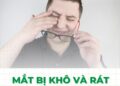 Mắt bị khô và rát