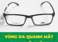 Vùng da quanh mắt bị khô rát