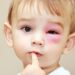 Đau mắt đỏ có nguy hiểm không