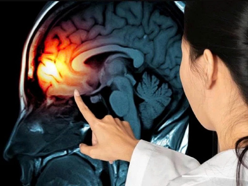 Tự nhiên mắt bị mờ là bệnh gì