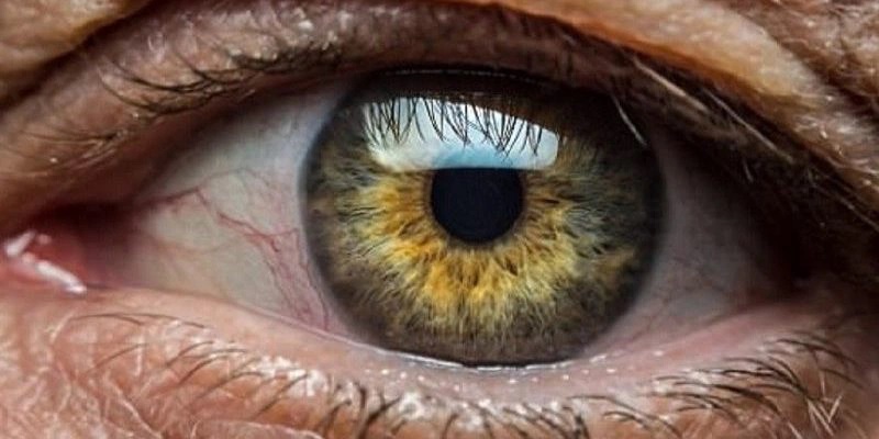 Thoái hóa điểm vàng thể ướt
