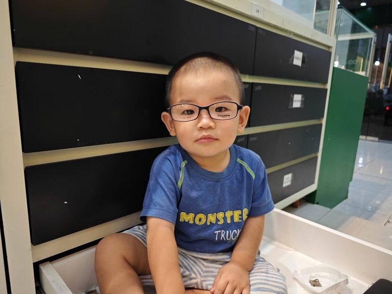 Nheo mắt có bị cận không