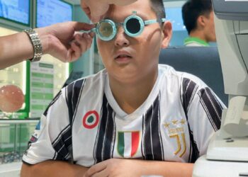 Bị loạn thị không đeo kính có sao không