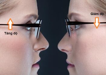 Đeo kính cận có bị lên độ không? Cách để không tăng độ cận