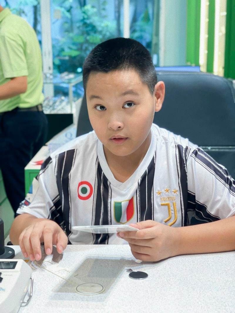 Bé bị loạn thị bẩm sinh