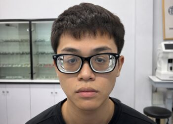 20 độ khi không có kính