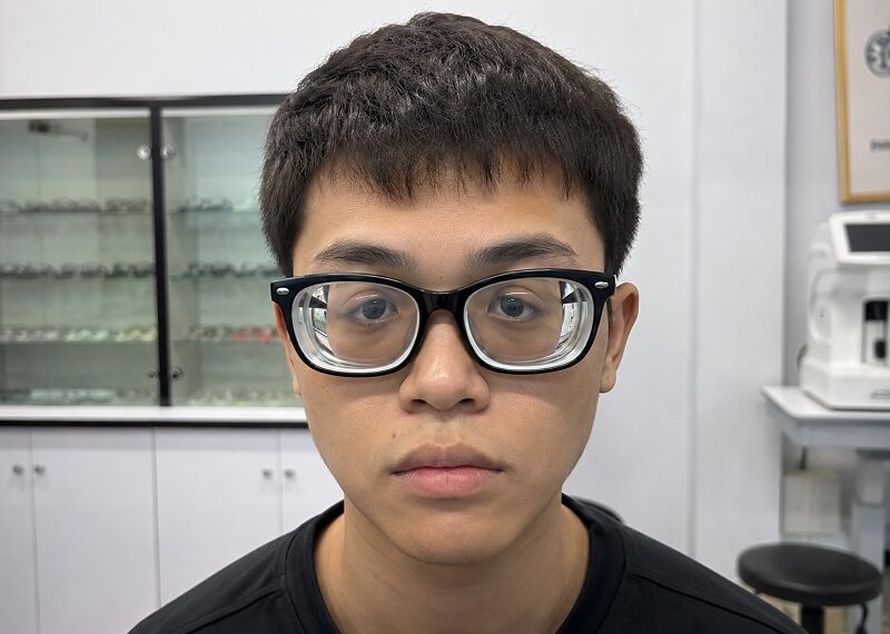 20 độ khi không có kính