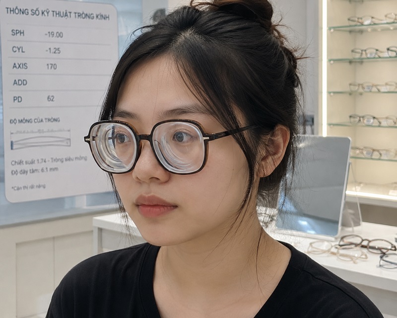 Mổ cận thị