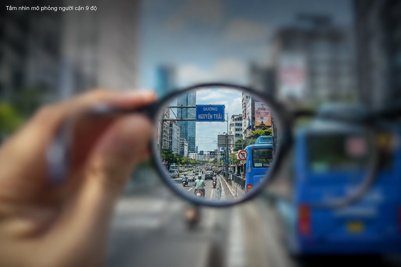 Cận 9 độ có mổ được không