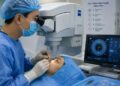 Bắn tia laser mắt cận bao nhiêu độ