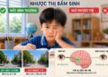 Cách chữa bệnh nhược thị