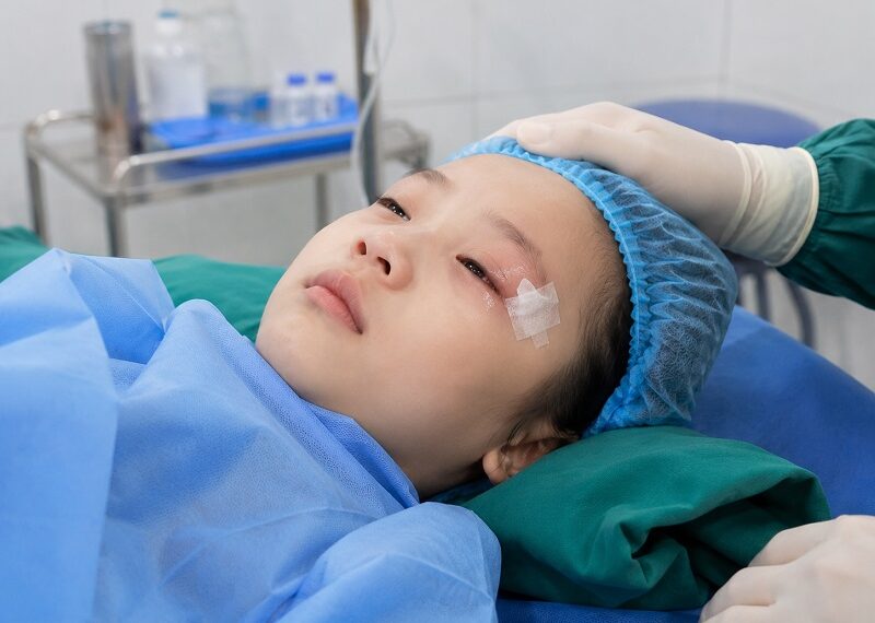 Mổ mắt lác bao lâu thì khỏi