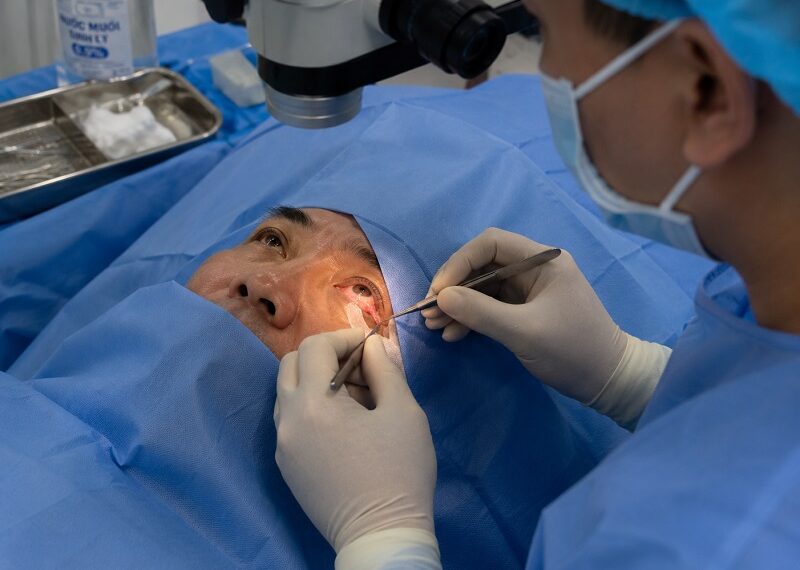 Sau khi mổ mộng mắt nên ăn gì