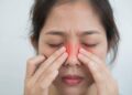 Viêm xoang có làm mờ mắt không