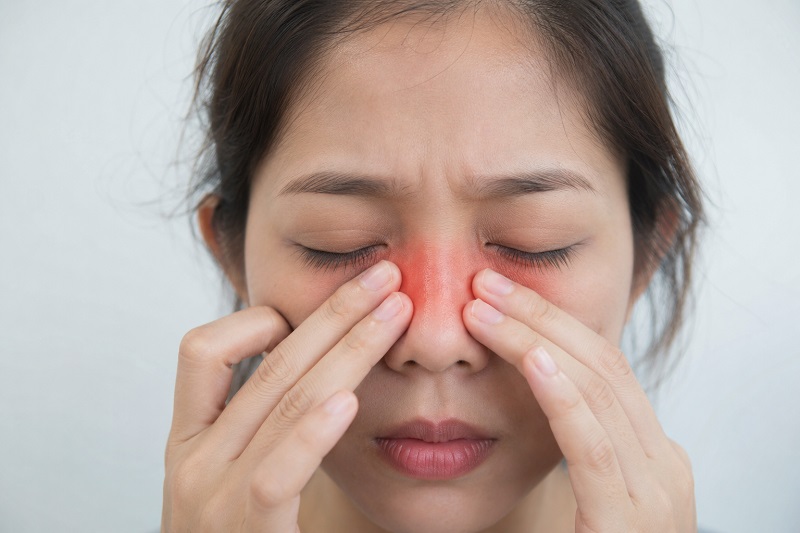 Viêm xoang có làm mờ mắt không